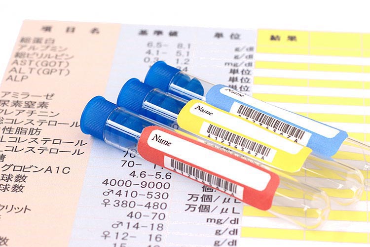 健康診断のイメージ画像