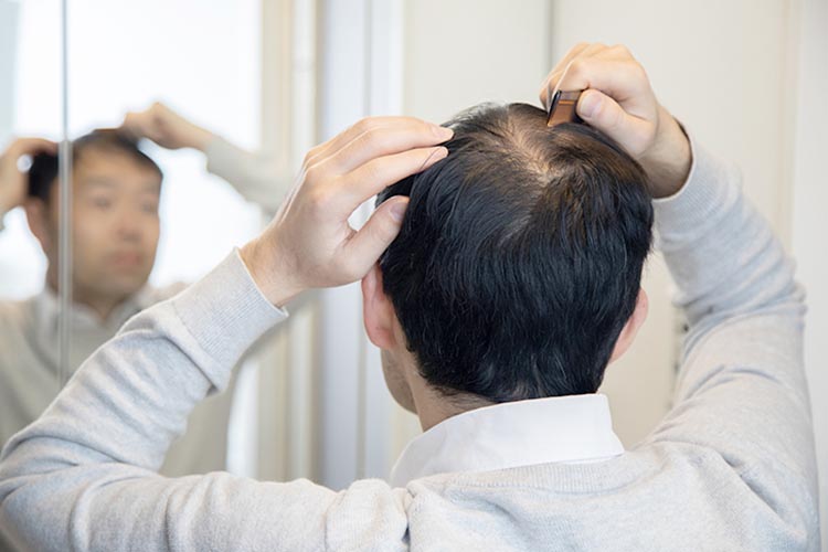 AGAのイメージ画像